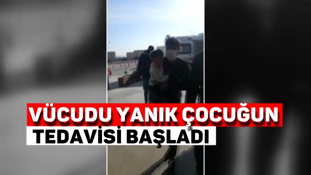 Tarsus’ta yaşayan Suriyeli çocuğun tedavisine başlandı